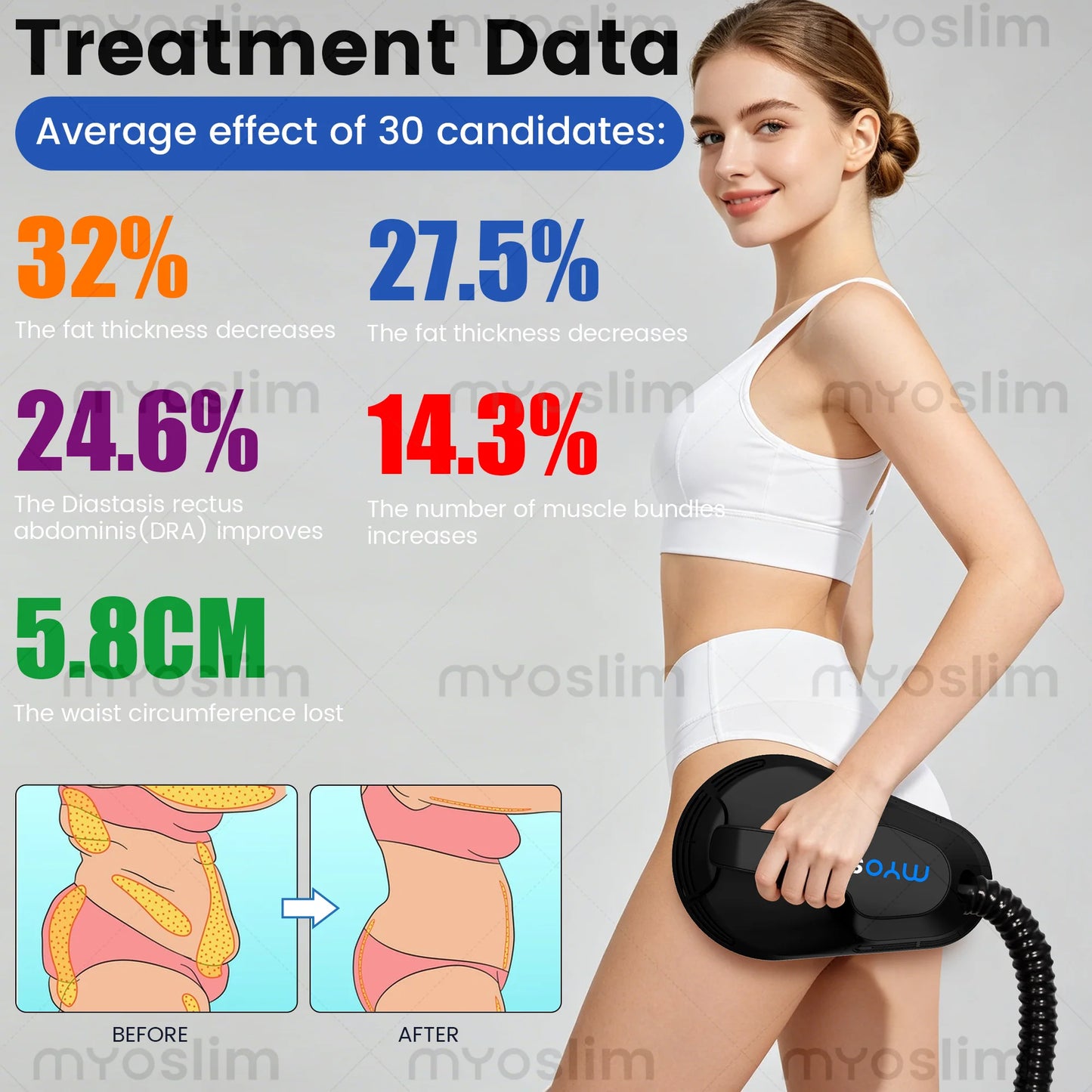Myoslim 6500W EMS Neo RF Body Sculpting Machine Pro