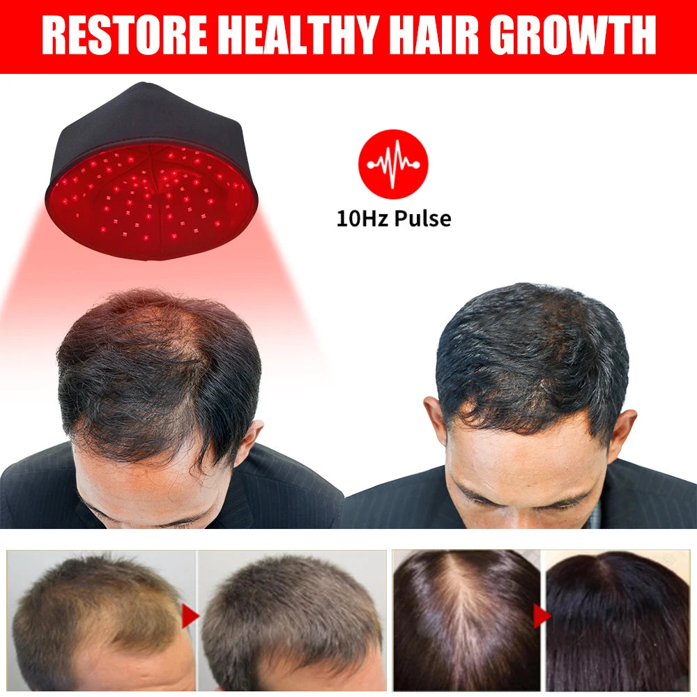 Red Light Hair Regrowth Cap Infrared Therapy 660nm 830nm